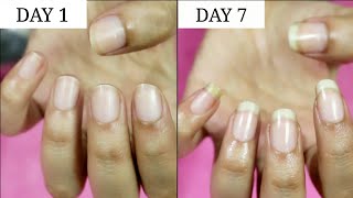 7 Days Nail Growth Challenge  Riya Beauty [upl. by Ida474]