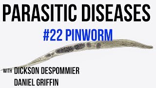 Parasitic Diseases Lectures 22 Pinworm [upl. by Loomis606]