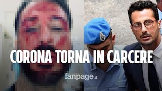 Fabrizio Corona deve tornare in carcere si taglia il braccio su Instagram quotQuesto è solo linizioquot [upl. by Rahr545]