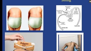 Scoliosis for the FRCS Orth exam [upl. by Salokin689]