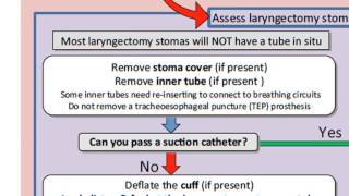 Emergency laryngectomy management [upl. by Riorsson]