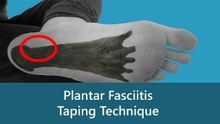 KT Tape Plantar Fasciitis Application Video [upl. by Fidelio]