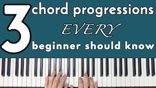 Common Chord Progressions Every Beginner Should Know [upl. by Nimrak783]