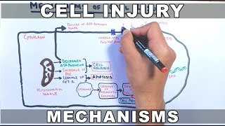 Mechanisms of Cell Injury [upl. by Giliana]