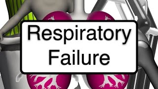 Nursing 101 Respiratory Failure [upl. by Henleigh]