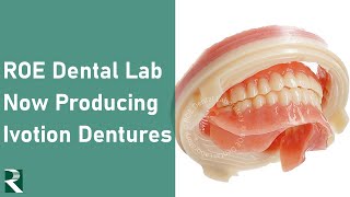 ROE Dental Lab Now Producing Ivotion Dentures [upl. by Atnicaj646]