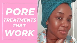 Treatment for Large Pores that WORK Black Skin [upl. by Margherita]