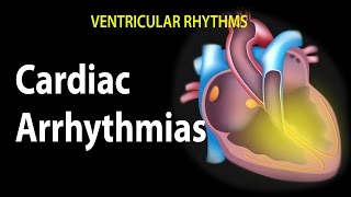 Cardiac Arrhythmias Animation [upl. by Ciro]