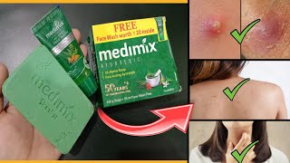 Medimix Ayurvedic Soap Review  Soap for all Skin Problems [upl. by Enomyar]