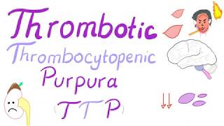 Improving Outcomes in TTP [upl. by Elam607]