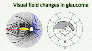 How To Improve Glaucoma – DrBerg On Glaucoma Treatment [upl. by Gniliem]