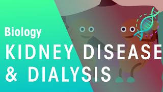 Kidney Renal Disease Signs amp Symptoms ex Peripheral Edema Fatigue Itchiness [upl. by Ydroj]