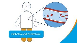 Diabetes and cholesterol  How it works  Diabetes UK [upl. by Ominorej]