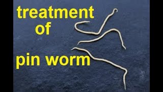 treatment of pin worms [upl. by Isleana14]