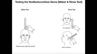 Interpreting the WeberRinne Tests EXPLAINED [upl. by Barret]