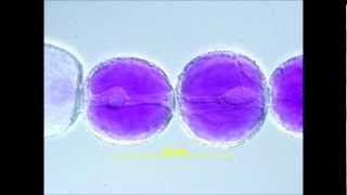 Cytoplasmic Streaming in Tradescantia Stamen Hair Cells [upl. by Naloc95]