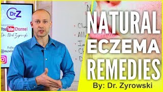 Natural Eczema Remedies  Actually Works [upl. by Sparhawk533]