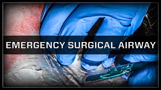 Emergency Surgical Airway  Cricothyroidotomy [upl. by Ecenahs459]