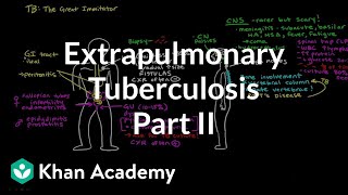 Interpreting the PPD  Infectious diseases  NCLEXRN  Khan Academy [upl. by Hasseman]