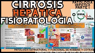 CIRROSIS HEPÁTICA FISIOPATOLOGÍA  GuiaMed [upl. by Kirit717]