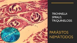 Trichinella Spiralis Triquinelosis Parásitos nemátodos [upl. by Gnof760]