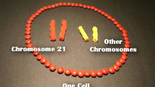 Nondisjunction Trisomy 21  An Animated Tutorial [upl. by Wolfson]