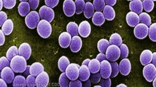 Staphylococcus aureus [upl. by Ihana]