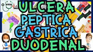 ÚLCERA PÉPTICA GÁSTRICA Y DUODENAL  GuiaMed [upl. by Ennayhs796]