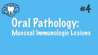 Oral Pathology  Mucosal Immunologic Diseases  INBDE ADAT [upl. by Monetta]