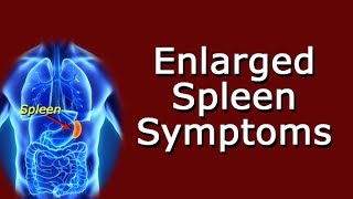 Enlarged Spleen Symptoms [upl. by Muirhead]