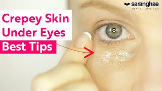 Crepey Skin Under The Eyes Top Tips To Help [upl. by Esyahc]