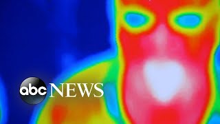 Breast cancer survivor shares cautionary tale about thermography  GMA [upl. by Hakon20]