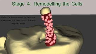 The Healing Process of the ACL Graft [upl. by Nij526]