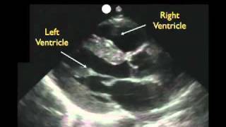 ERCP Procedure  Endoscopic retrograde cholangiopancreatography  biliary imaging system part 3 [upl. by Eyllib655]