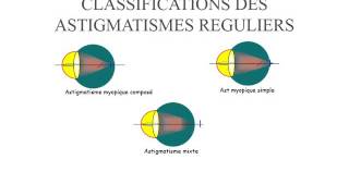 BIOPHYSIQUE Astigmatisme [upl. by Petronia]