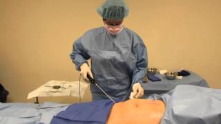 Minimally invasive awake liposuction [upl. by Talya]