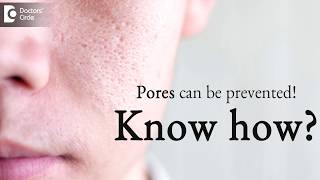 How to prevent pores on face  DrKC Nischal  Doctors Circle [upl. by Lorilyn394]