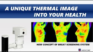 IRISXP Infrared Thermography Imaging System For Medical Use [upl. by Ives852]