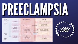 Preeclampsia Explicada Claramente [upl. by Falda]