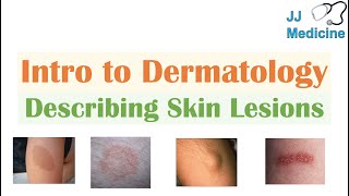 Introduction to Dermatology  The Basics  Describing Skin Lesions Primary amp Secondary Morphology [upl. by Stilwell955]