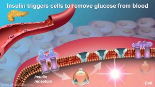 Understanding Type 2 Diabetes [upl. by Mars]