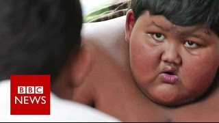 My 10yearold son weighs 188kg  BBC News [upl. by Dion]