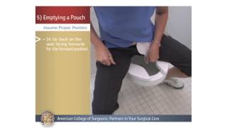 ColostomyIleostomy Changing a Pouch [upl. by Sorce829]