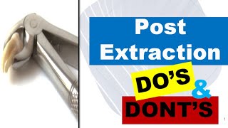 DENTAL POST EXTRACTION INSTRUCTIONS [upl. by Cullen]