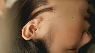 Why Does Fluid Build Up Behind The Eardrum Otitis Media With Effusion [upl. by Maker]