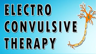 Electroconvulsive Therapy [upl. by Kano]