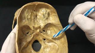 Skull Osteology  Cranial Cavity Anatomy [upl. by Atiekram723]