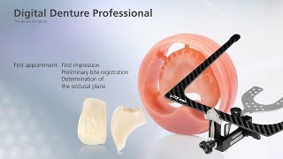 Digital Denture – first Appointment [upl. by Kistner]