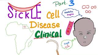 The Problem With Sickled Cells [upl. by Peppie946]