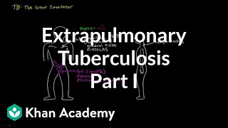 Extrapulmonary TB Part 2  Infectious diseases  NCLEXRN  Khan Academy [upl. by Kally177]